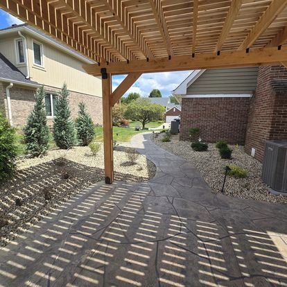 pergola